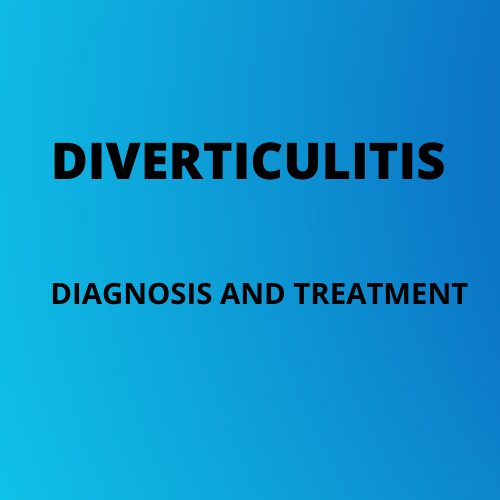 Diverticulitis Diagnosis And Treatment