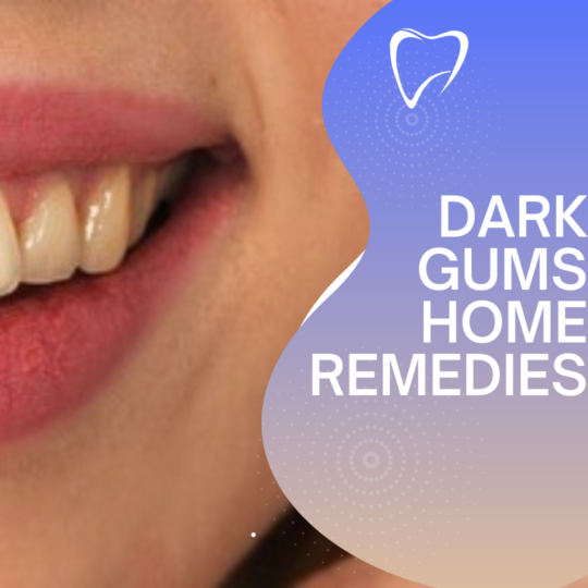 Dark gums